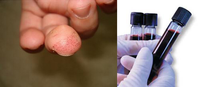 高风险赌博 职业车手嗑药原因深度剖析