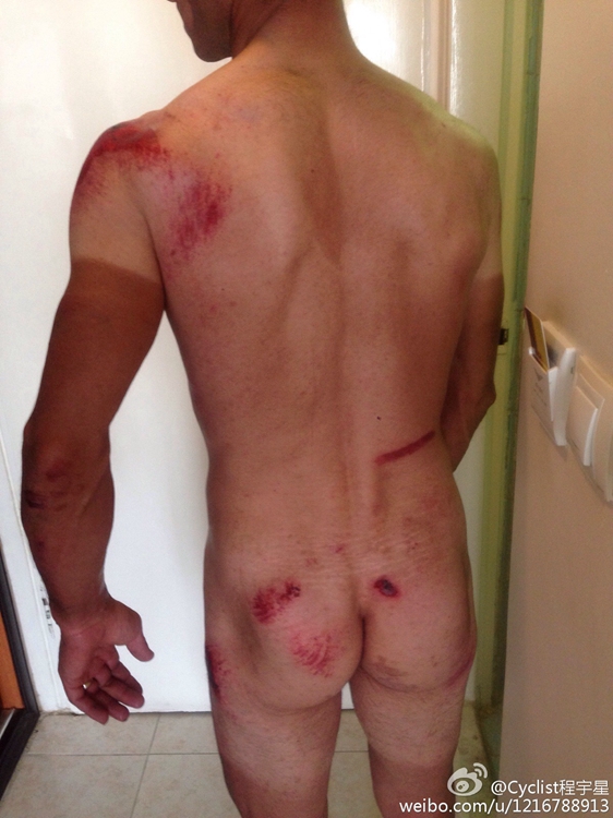 车手受伤 车手受伤